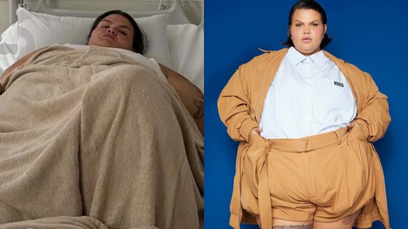Thais Carla: Antes e depois da cirurgia bariátrica