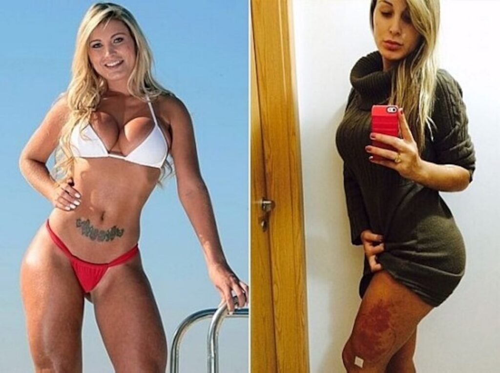 Andressa Urach cirurgias estéticas desastrosas