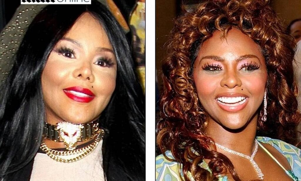 Lil' Kim procedimento cirurgia que deu errado