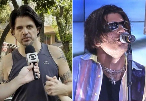 Marcus Menna antes e depois cirurgias estéticas desastrosas