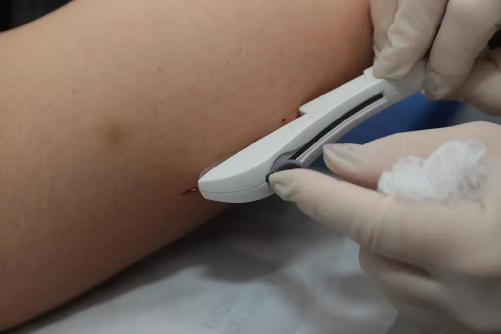 implante contraceptivo SUS