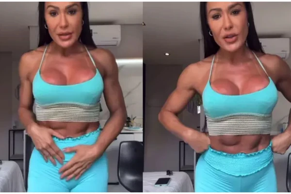 gracyanne barbosa 20Kg após cirurgia