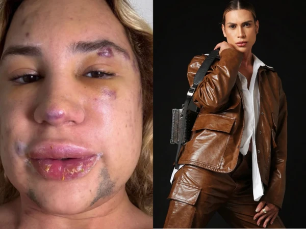 Influenciador Juior dutra morre após procedimento