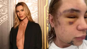 junior-dutra-fox-dutra