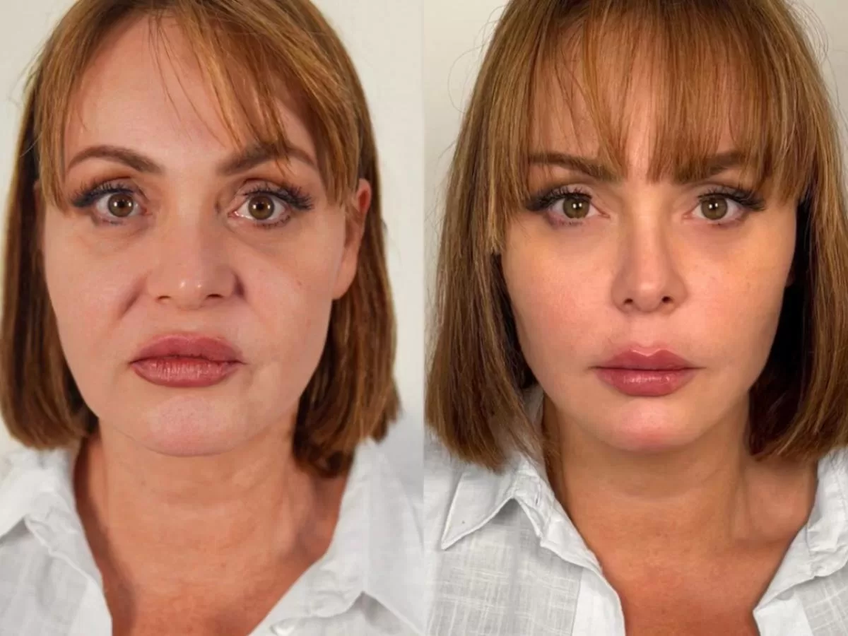 gaby spanic harmonização facial