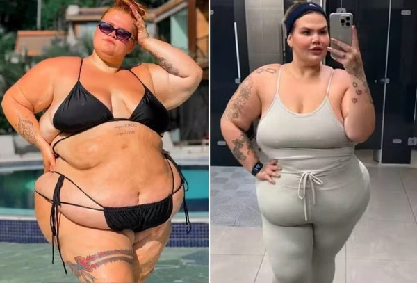 antes-e-depois-de-thais-carla-iniciar-processo-de-emagrecimento