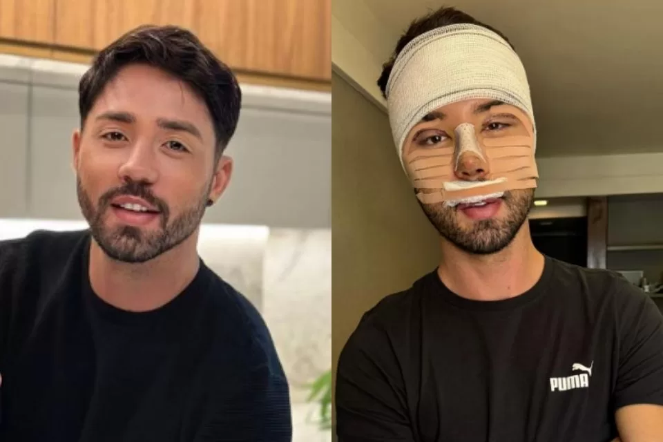 Rico-Melquiades-cirugia estetica